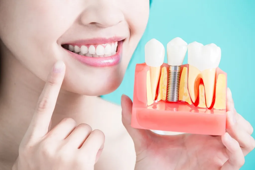 Dental Implant Placement vs. Implant Restoration: What’s the Difference?