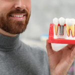 Man holding educational model of dental implant on blurred background, closeup.